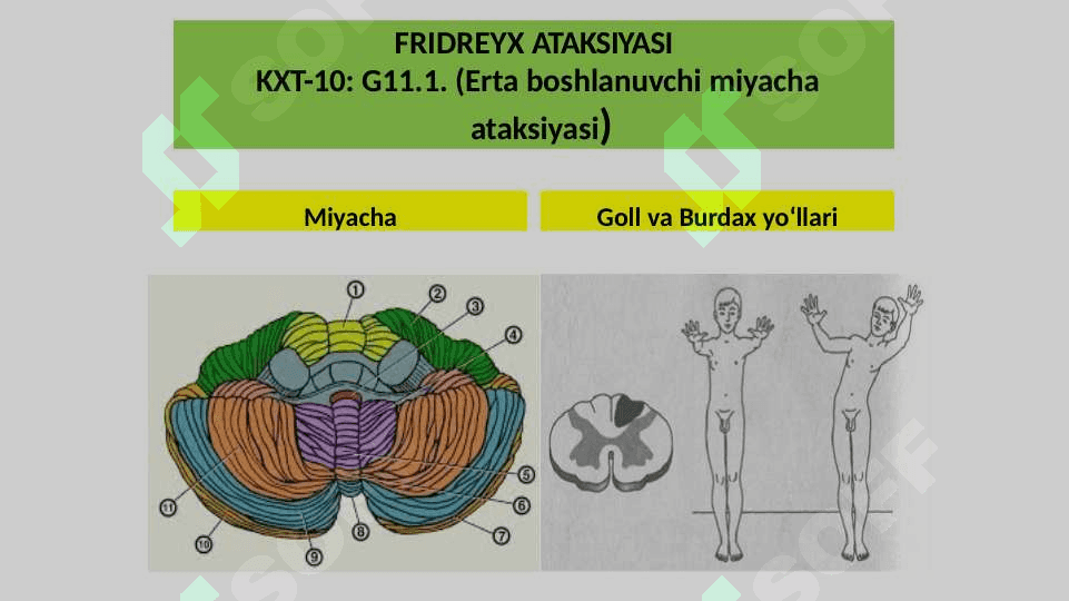 Nasliy asab kasalliklari 5
