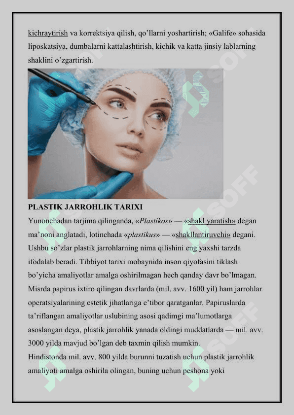 FILATOVNING BANDI PLASTIKASI 3
