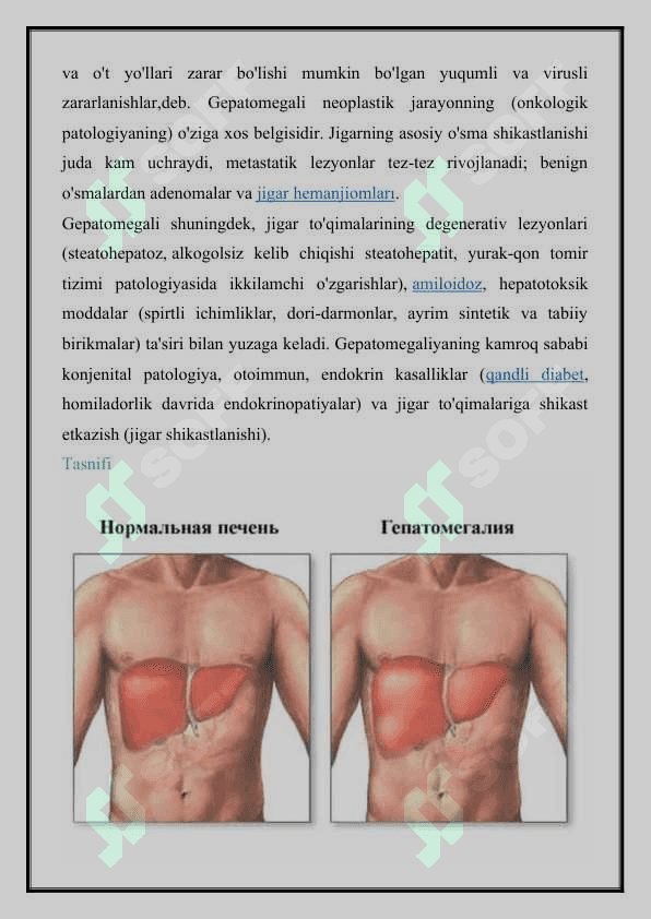 GEPATOMEGALIYA BILAN KECHUVCHI KASALLIKLAR ETIOPATOGENEZI 3
