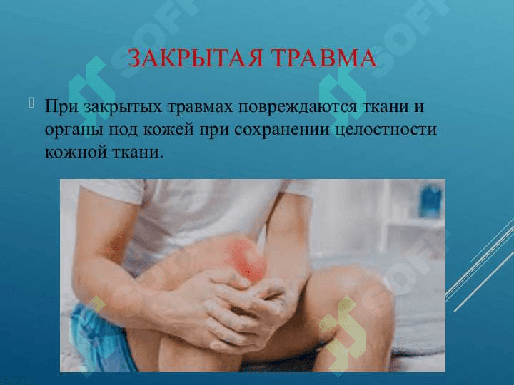 Закрытые повреждения тканей 8