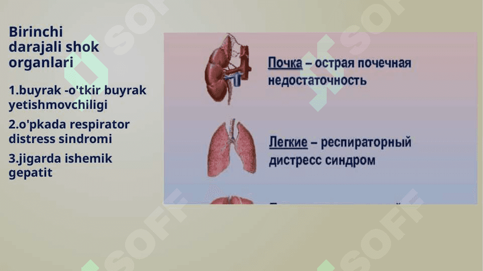 Obstruktiv shok 4