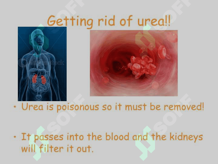 Kidney 5