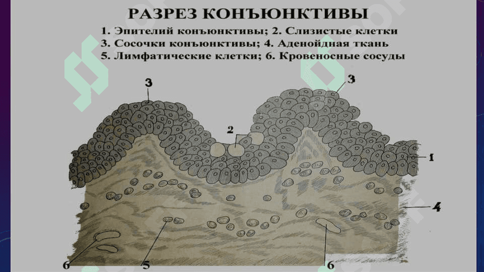 Konyunktiva tuzilishi funksiyasi Bakterial Konyuktivit 4
