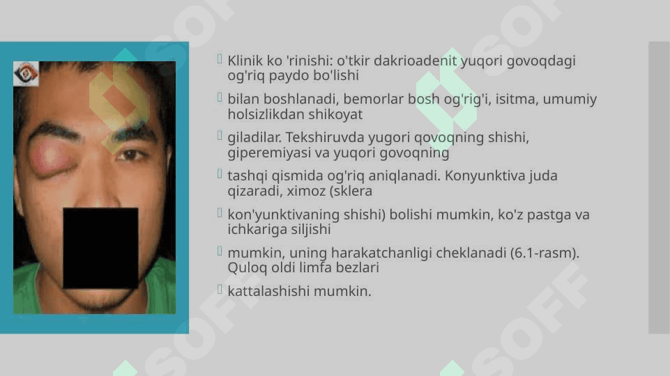 Dakriodent ko”z yosh apparati 4