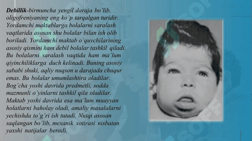 Aqliy nogironlikning turli shakllari etnologiyasi va patogenezi aqliy zaiflikning xronologik yoshi zaiflik darajasi aqliy nutq va ijtimoiy faoliyat darajasi bo'yicha rivojlanish xususiyatlari 8