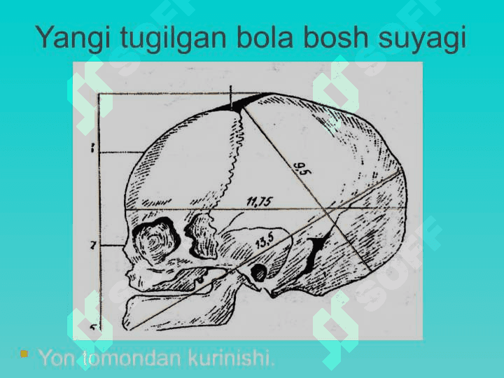 Suyak-bugim kasalliklari semiotikasi 8