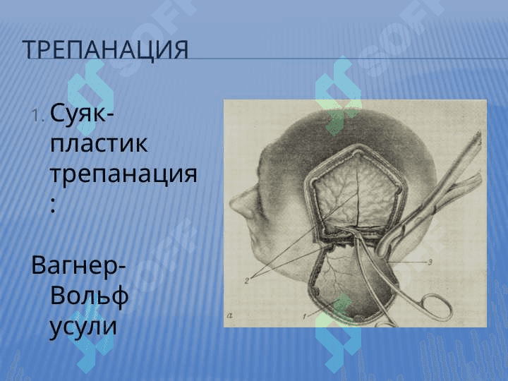 БОШ СОХАСИ БОШНИНГ МИЯ СОХАСИ КЛИНИК  АНАТОМИЯСИ ВА ОПЕРАТИВ ЖАРРОХЛИГИ 8