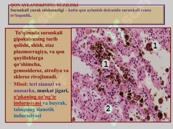 Qon aylanishining buzilishi. Arterial va venoz toʻlaqonlik. Qon ketishi 7