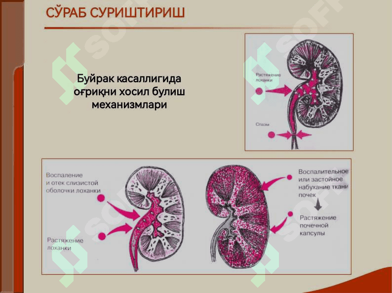 БУЙРАК КАСАЛЛИГИ БИЛАН ОҒРИГАН БЕМОРЛАРНИ ТЕКШИРИШ. АСОСИЙ КЛИНИК СИНДРОМЛАР. БУЙРАК ЕТИШМОВЧИЛИГИ 5