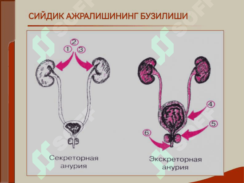 БУЙРАК КАСАЛЛИГИ БИЛАН ОҒРИГАН БЕМОРЛАРНИ ТЕКШИРИШ. АСОСИЙ КЛИНИК СИНДРОМЛАР. БУЙРАК ЕТИШМОВЧИЛИГИ 8