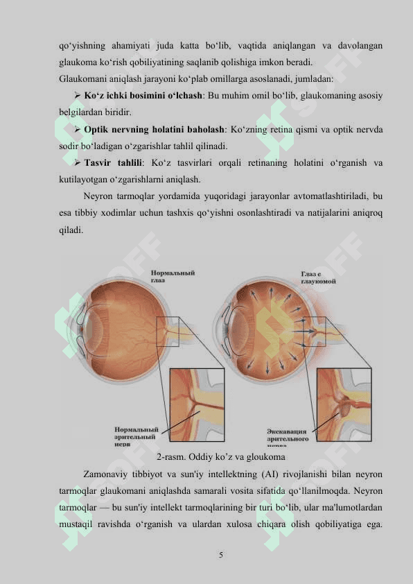 Sun’iy intellekt usullari yordamida ko‘z kasalliklarini aniqlash dasturini ishlab chiqish 5