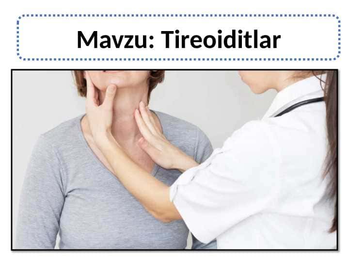 Tireoiditlar