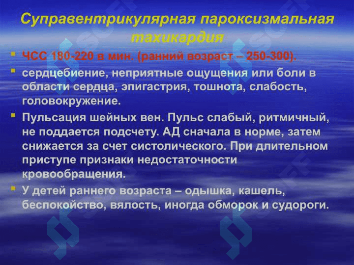 Аритмии у детей 7