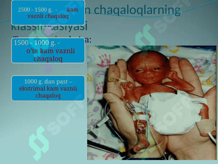 Chala tug’ilgan chaqaloqlar 4