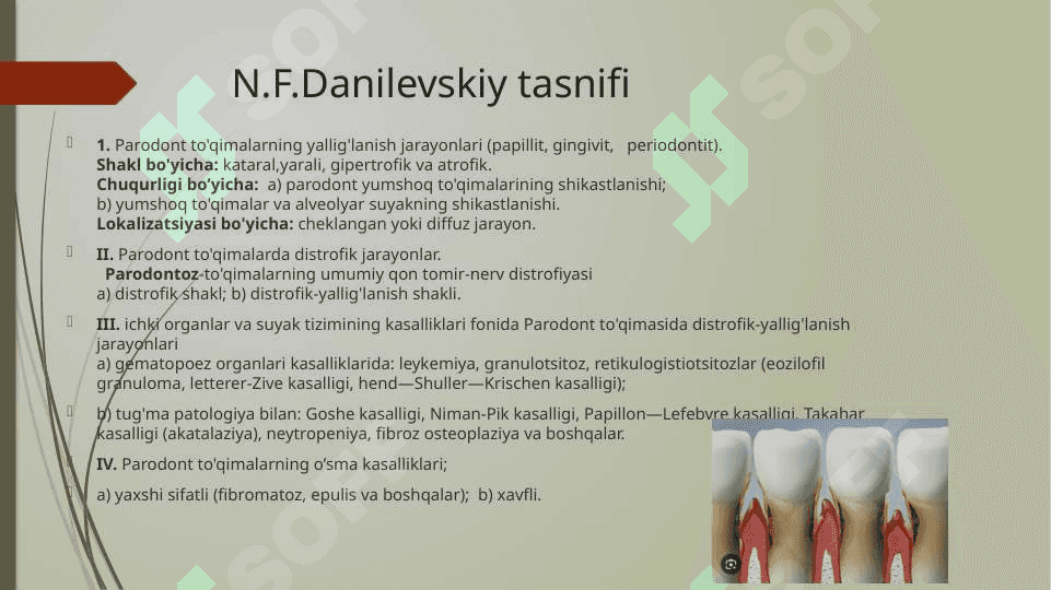 Parodont kasalliklar tasnifi.Bemorlarni tekshirish usullari 6