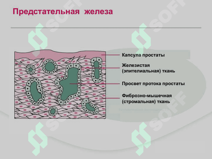 Доброкачественная гиперплазия предстательной железы ДГПЖ 6