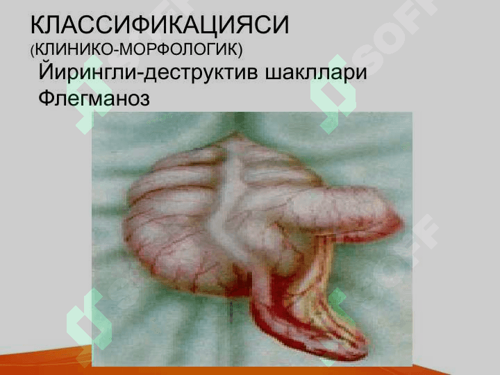 Bolalarda o'tkir qorin kasalliklar belgilari va umumiy amaliyot shifikori taktikasi . Болаларда ўткир корин касалликлар белгилари ва умум амалиёт врачлари тактикаси 5