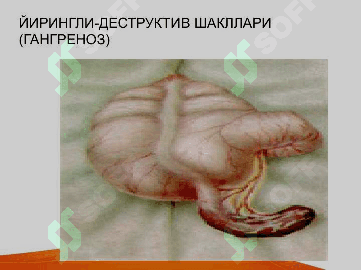 Bolalarda o'tkir qorin kasalliklar belgilari va umumiy amaliyot shifikori taktikasi . Болаларда ўткир корин касалликлар белгилари ва умум амалиёт врачлари тактикаси 6