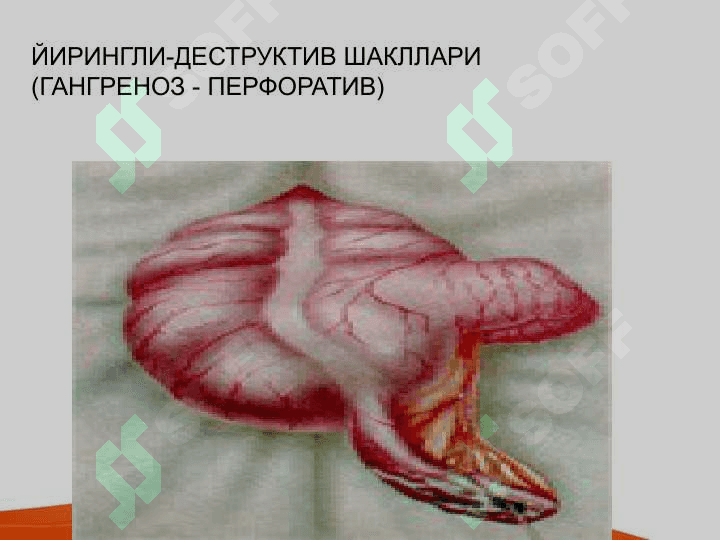 Bolalarda o'tkir qorin kasalliklar belgilari va umumiy amaliyot shifikori taktikasi . Болаларда ўткир корин касалликлар белгилари ва умум амалиёт врачлари тактикаси 7