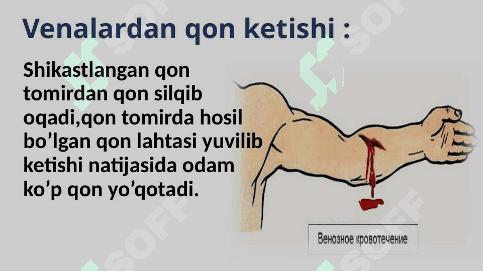Tomirlardan qon ketganda birinchi yordam ko’rsatish 6