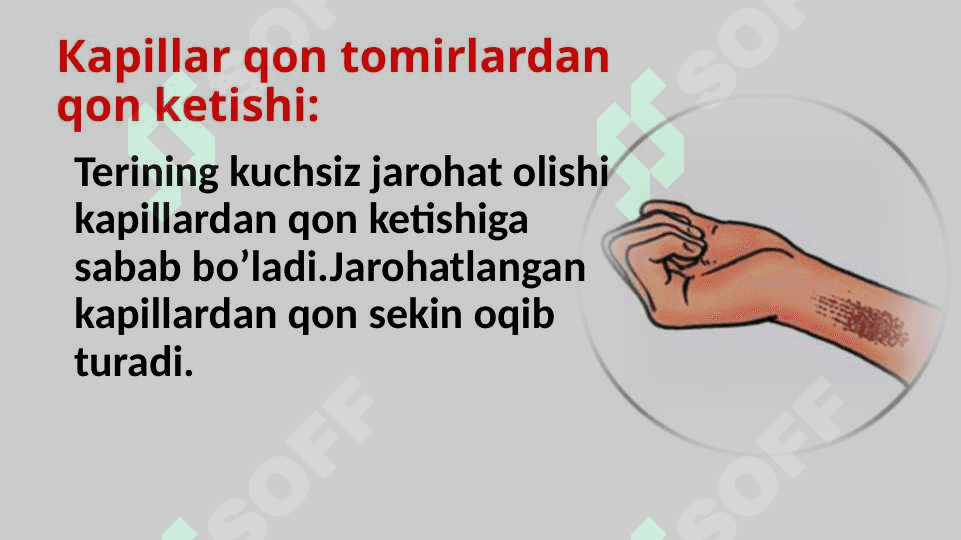 Tomirlardan qon ketganda birinchi yordam ko’rsatish 7