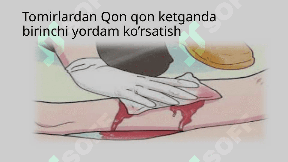 Tomirlardan qon ketganda birinchi yordam ko’rsatish 8
