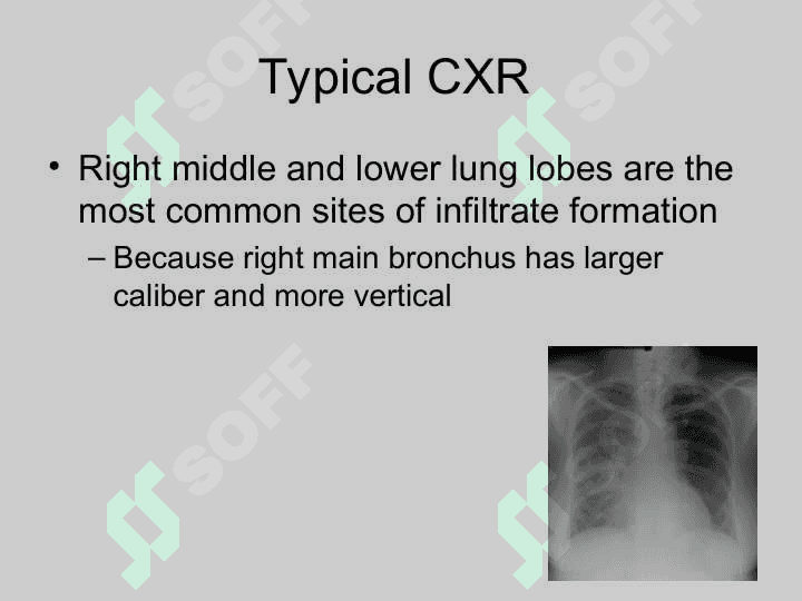 Management of Aspiration Pneumonia 6