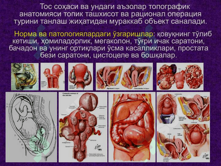 Тос соҳаси клиник анатомияси.   Тос бўшлиғи аъзоларидаги асосий операциялар. 4