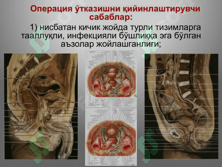 Тос соҳаси клиник анатомияси.   Тос бўшлиғи аъзоларидаги асосий операциялар. 5