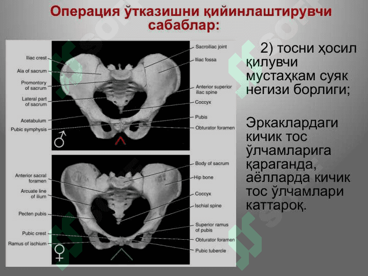 Тос соҳаси клиник анатомияси.   Тос бўшлиғи аъзоларидаги асосий операциялар. 6