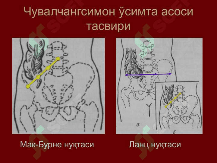 Қорин деворлари клиник анатомияси 6