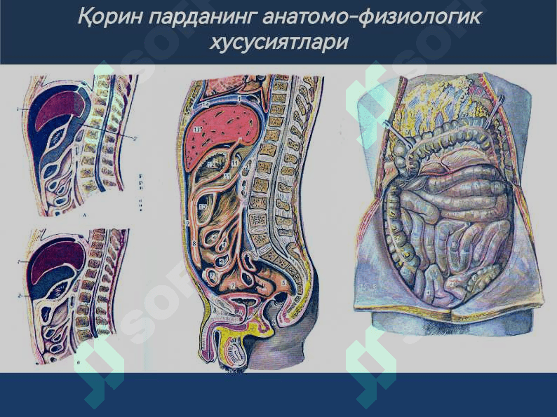 Гинекологик перитонитлар 5
