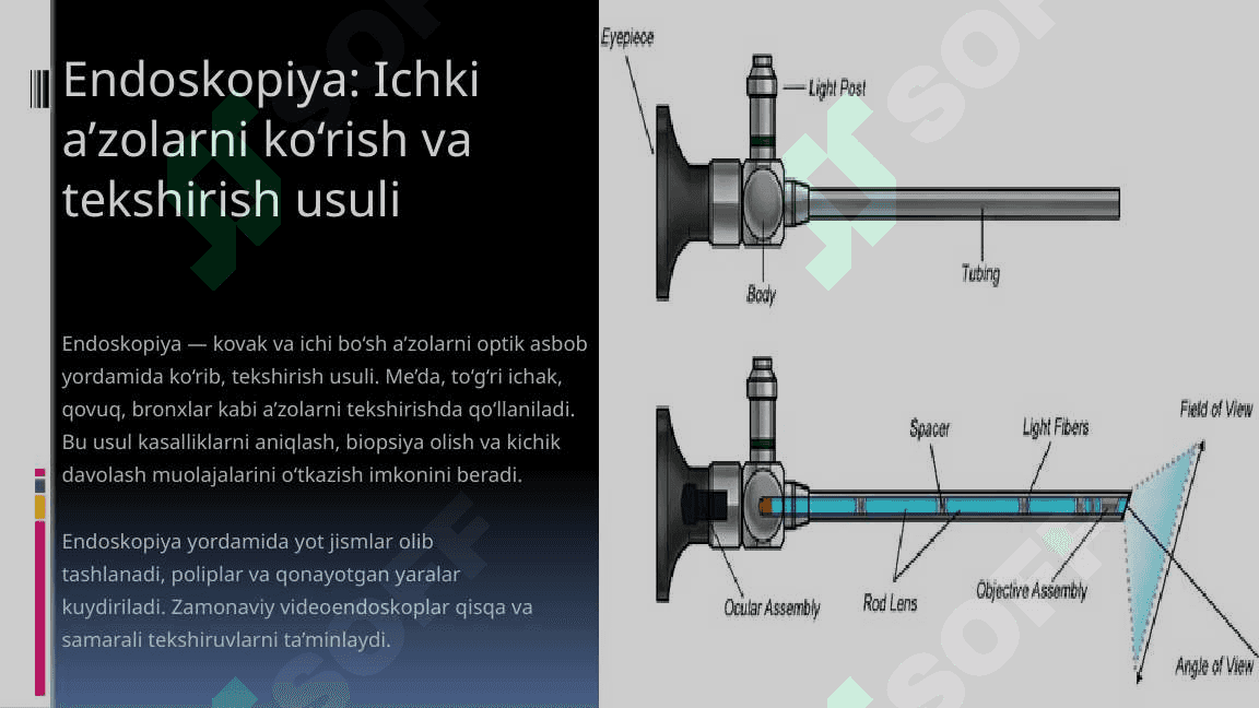 Tibbiyotda endoskopik usullarning qo'llanilishi | Enoskopiya 3