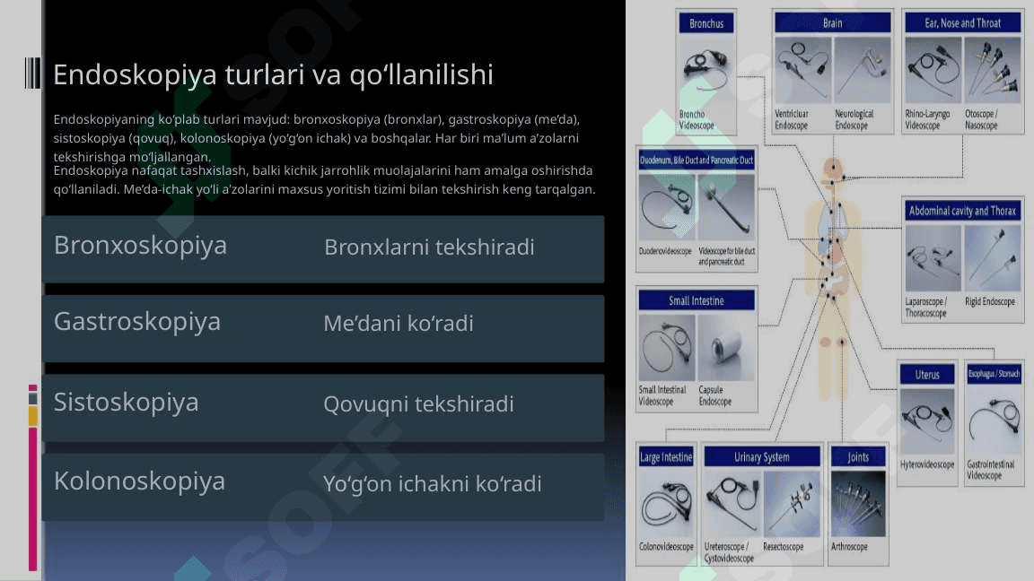 Tibbiyotda endoskopik usullarning qo'llanilishi | Enoskopiya 4