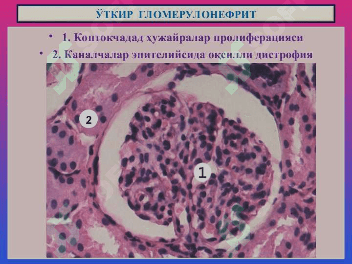 БУЙРАК  КАСАЛЛИКЛАРИ 8