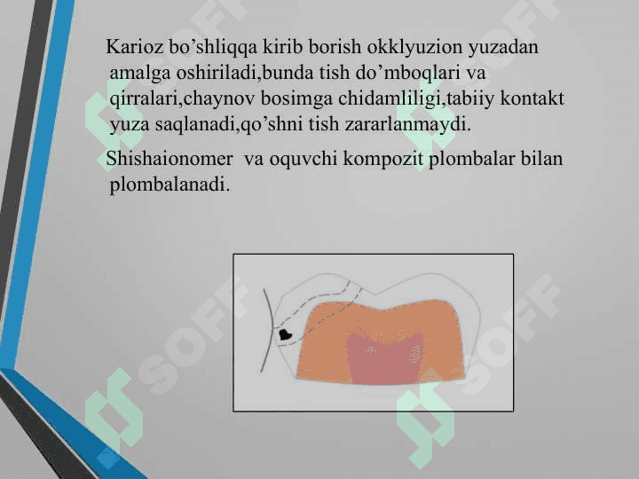 Tunnelli charxlash usuli PPT 4
