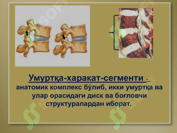 Умуртқа поғонаси остеохондрози 6