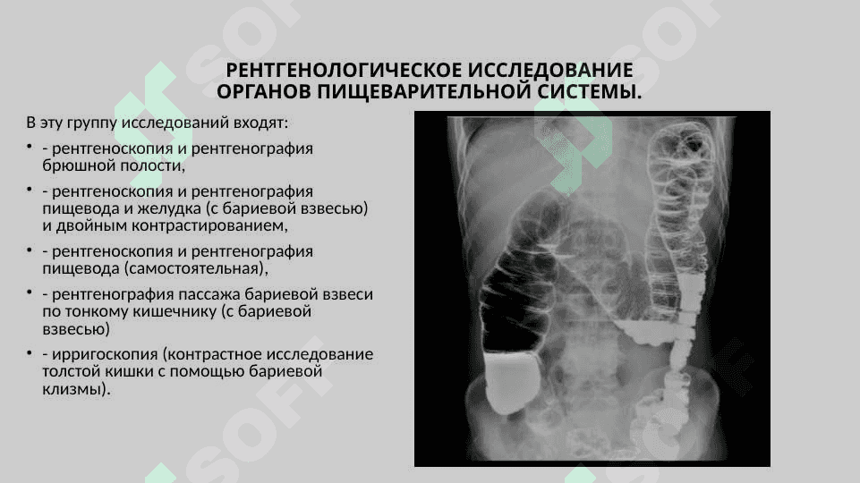 Рентгеноанатомия органов пищеварения и их пороки развития. Рентгеноанатомия зубов. Аномалии прикуса и развития зубов 2
