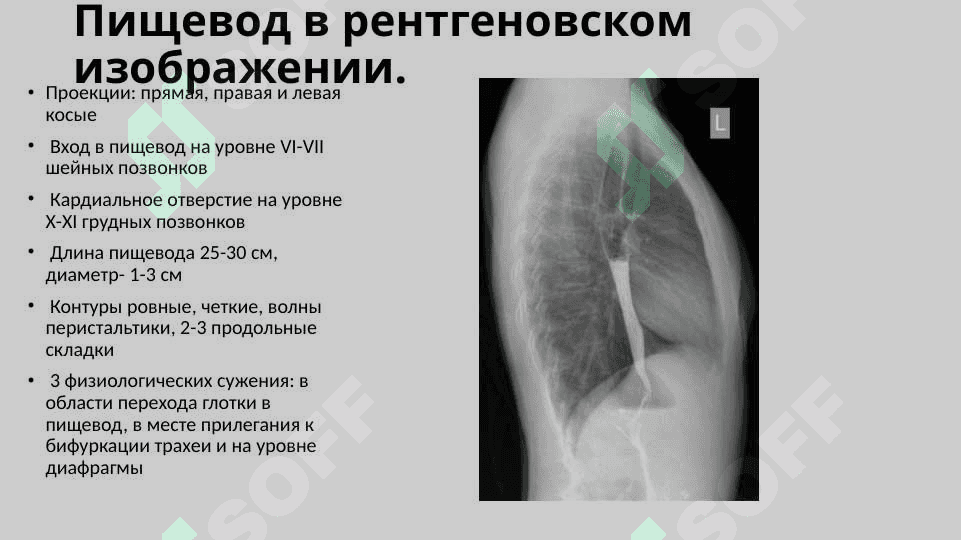 Рентгеноанатомия органов пищеварения и их пороки развития. Рентгеноанатомия зубов. Аномалии прикуса и развития зубов 3