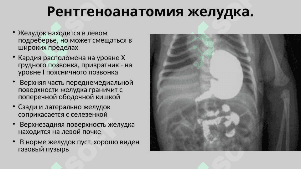 Рентгеноанатомия органов пищеварения и их пороки развития. Рентгеноанатомия зубов. Аномалии прикуса и развития зубов 4
