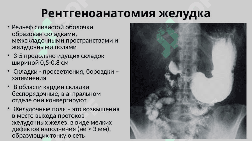 Рентгеноанатомия органов пищеварения и их пороки развития. Рентгеноанатомия зубов. Аномалии прикуса и развития зубов 5