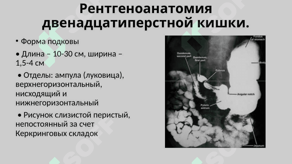 Рентгеноанатомия органов пищеварения и их пороки развития. Рентгеноанатомия зубов. Аномалии прикуса и развития зубов 6