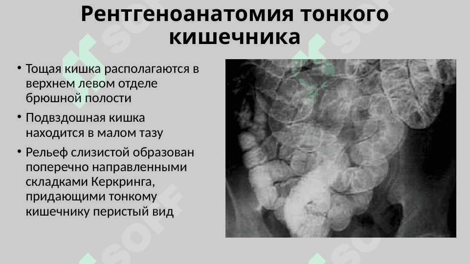 Рентгеноанатомия органов пищеварения и их пороки развития. Рентгеноанатомия зубов. Аномалии прикуса и развития зубов 7