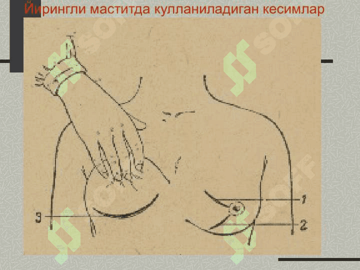 Сут бези 8