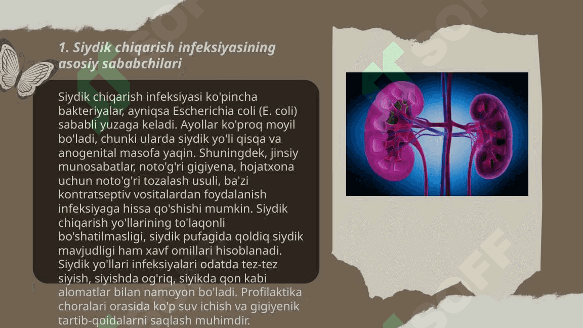 Siydik chiqarish infeksiyasi, etiologiya, patogenezi, klinika, diagnostika, davolash 3