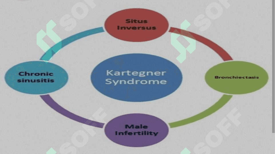 KARTAGENER SINDROMI ppt pptx 4