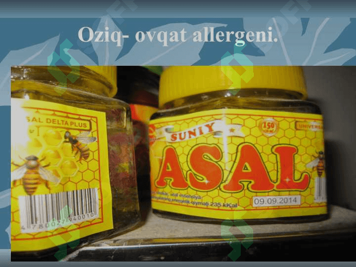 O’tkir allergozlar slayd ppt pptx 5