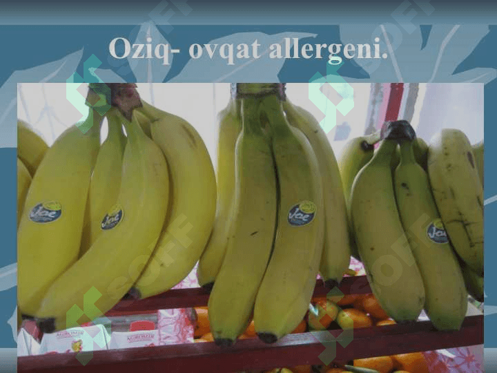 O’tkir allergozlar slayd ppt pptx 7