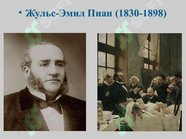 Ошкозон ва 12 бармокли ичак  яра касаллиги 2