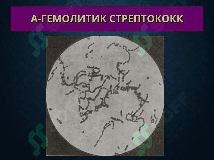 Терининг йирингли касалликлари 8